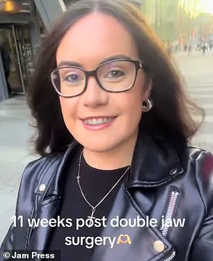 From Shame to Confidence: How a Severe Underbite Shaped a Woman's Journey and Highlighted Community Perceptions of Physical Appearance