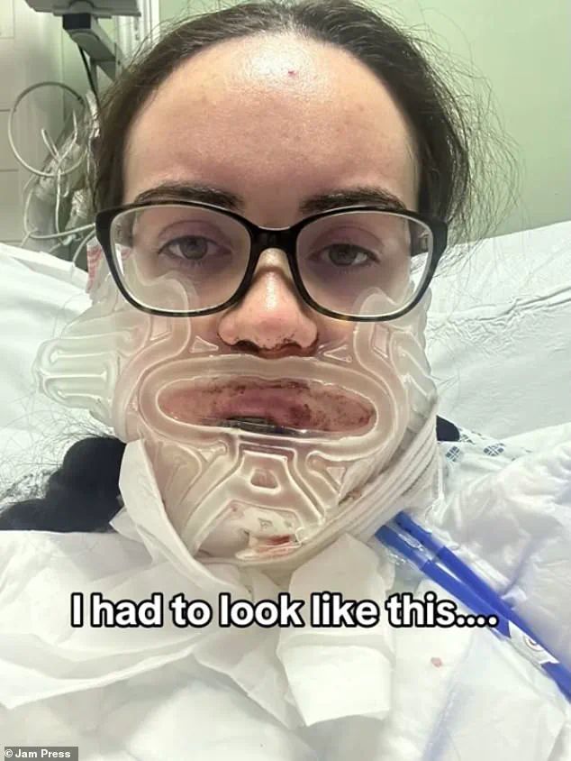 From Shame to Confidence: How a Severe Underbite Shaped a Woman's Journey and Highlighted Community Perceptions of Physical Appearance