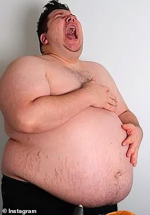 The Hidden Cost of Rapid Weight Loss: A Surge in Sagging Skin as Ozempic and Wegovy Users Seek Solutions