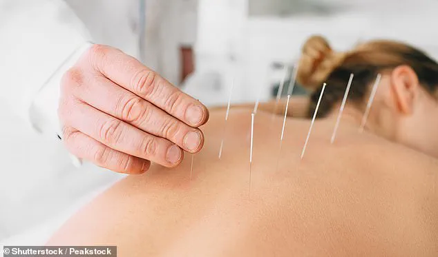 Kaiser Permanente Study Reveals Acupuncture Offers Sustained Relief for Chronic Back Pain in Older Adults
