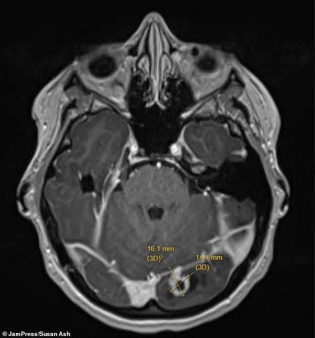 New Mother's Vision Problems Lead to Devastating Brain Tumor Diagnosis