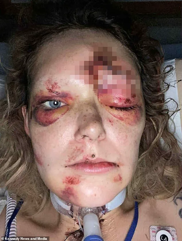 The Lasting Impact of the Accident on White's Health and Well-Being