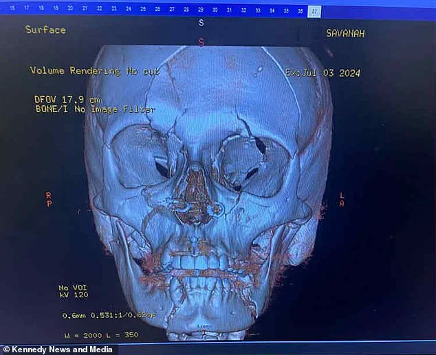The Lasting Impact of the Accident on White's Health and Well-Being