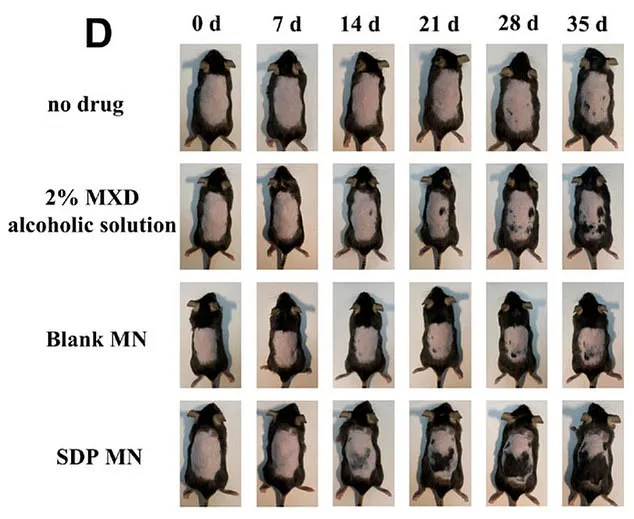 Controversial Study Suggests Stevia May Reverse Hair Loss