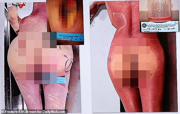 Libby Adame, Infamously Dubbed the 'Butt Lady,' Convicted of Second-Degree Murder in Death of TV Actress Cindyana Santangelo from Silicone Injection Complications