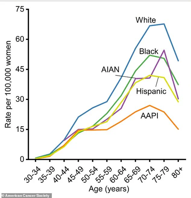 Rising Incidence of Lobular Breast Cancer Reveals Diminishing Survival Advantage Over Time