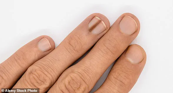 The Body's 'Whispers': Why Early Symptoms May Signal Serious Illness, Experts Warn