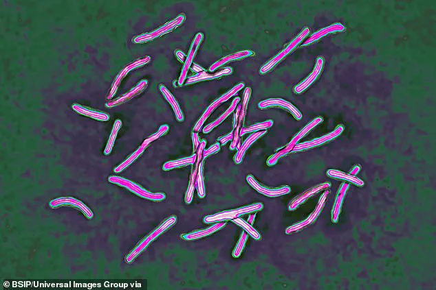 UK Health Officials Sound Alarm Over Surging Tuberculosis Cases, Citing 13.6% Increase in 2024 as Public Health Concerns Mount