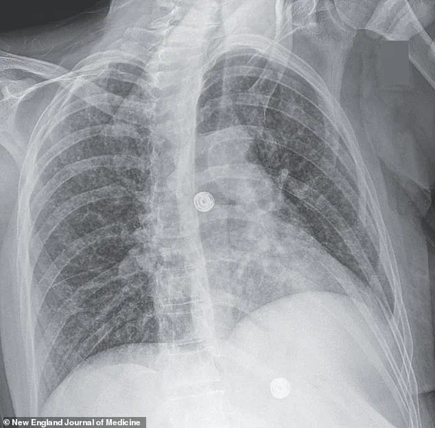 A Medical Mystery at Massachusetts General Hospital: The Complex Crisis of a Woman Struggling with Mental Illness, Poverty, and Addiction