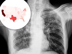 A Medical Mystery at Massachusetts General Hospital: The Complex Crisis of a Woman Struggling with Mental Illness, Poverty, and Addiction