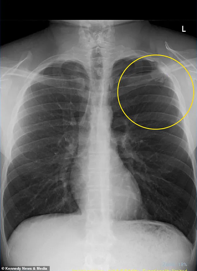 The Vaping Epidemic: How Regulatory Shortcomings Undermine Public Health Efforts