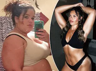 Melissa Schloemer's Journey to Weight Loss Surgery: A Path to Transformation