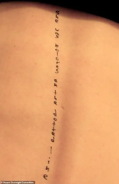 DOJ Releases Jeffrey Epstein Files as Mental Health Experts Warn of Psychological Toll on Survivors