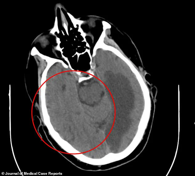 Medical Mystery in Waterford: 76-Year-Old Man's Levitating Arm and Animal Visions