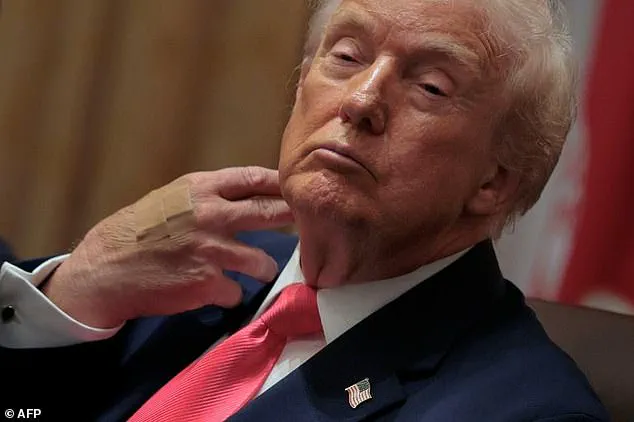 Fact-Checking Donald Trump's Health Claims: Evidence Suggests Otherwise as 79-Year-Old President Faces Scrutiny Over Vitality