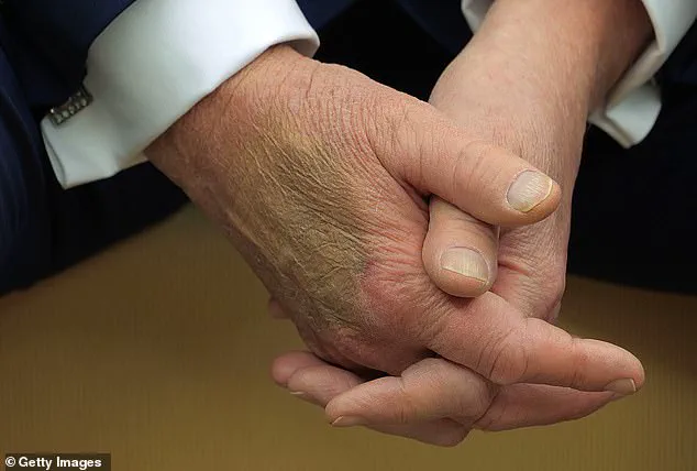 Breaking: President Trump Reveals Daily Aspirin Regimen for Cardiac Prevention in Exclusive WSJ Interview