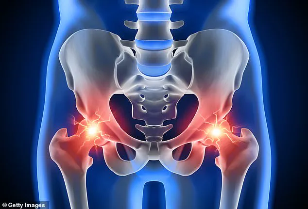 Hip Pain: A Silent Epidemic Affecting 1 in 10 British Adults and Eroding Quality of Life
