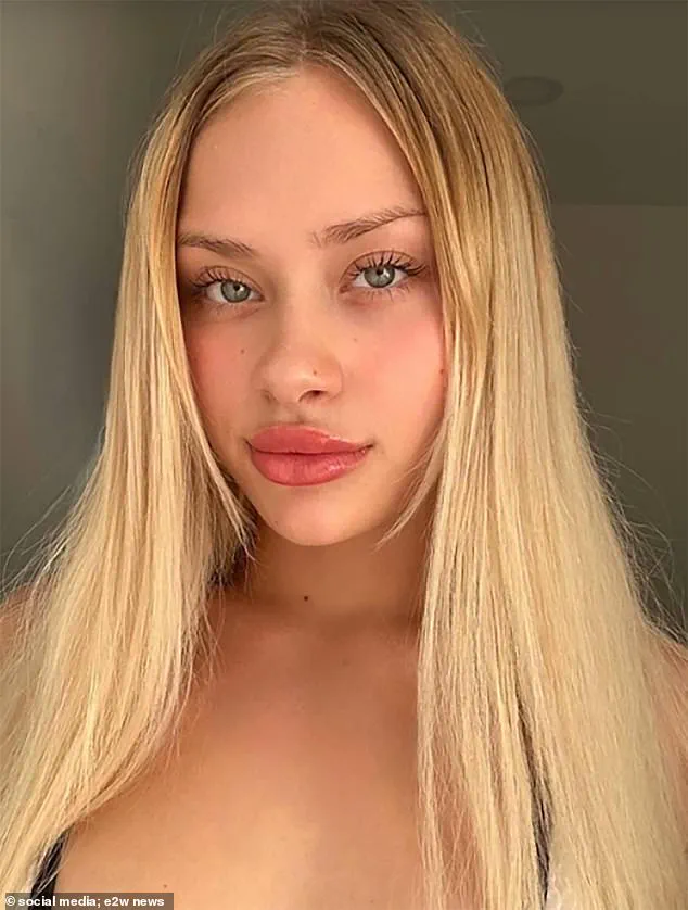 Ukrainian Woman's Remarkable Recovery After Dubai Incident Highlights Resilience and Rehabilitation Success