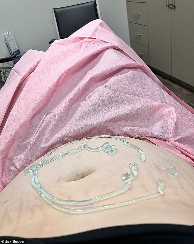 Breaking: Transgender Man in Rural Texas to Give Birth and Surrender Baby for Adoption