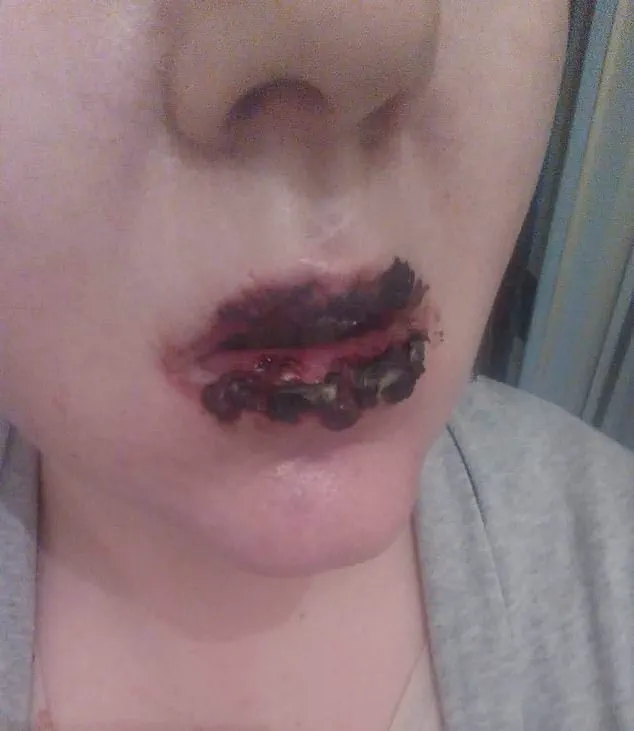 Urgent Warning: Benylin Linked to Permanent Health Effects After Routine Use – Late-Breaking Update