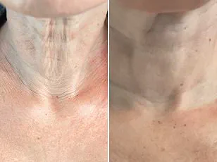 Growing Number of UK Women Experience Hair Loss, Prompting Medical Concerns