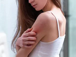 Withdrawal of Palforzia Raises Concerns for Peanut Allergy Patients and Healthcare Providers