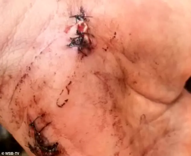 Exclusive: Georgia Groom's Wedding Day Shooting Sparks Legal and Moral Debate Over Self-Defense Claim