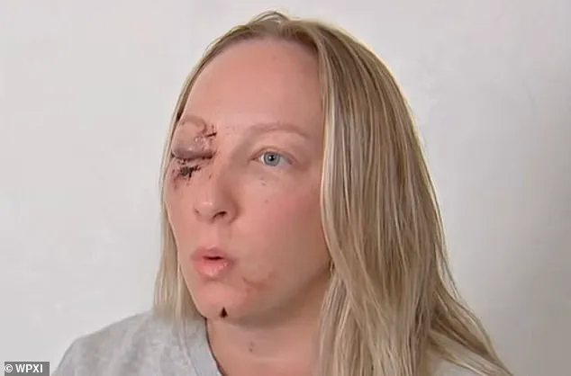 Ice Slab from Tractor-Trailer Shatters Windshield, Leaves Mother with Severe Injuries Near Pittsburgh