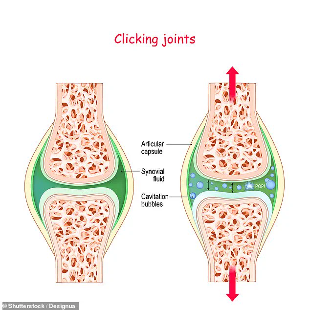 The Science Behind Joint Cracking: Debunking the Arthritis Myth