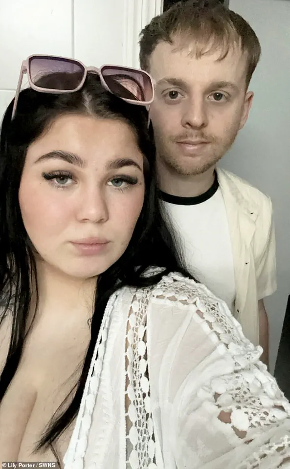 NHS Refuses Breast Reduction for Young Woman with Sepsis Risk Despite High BMI