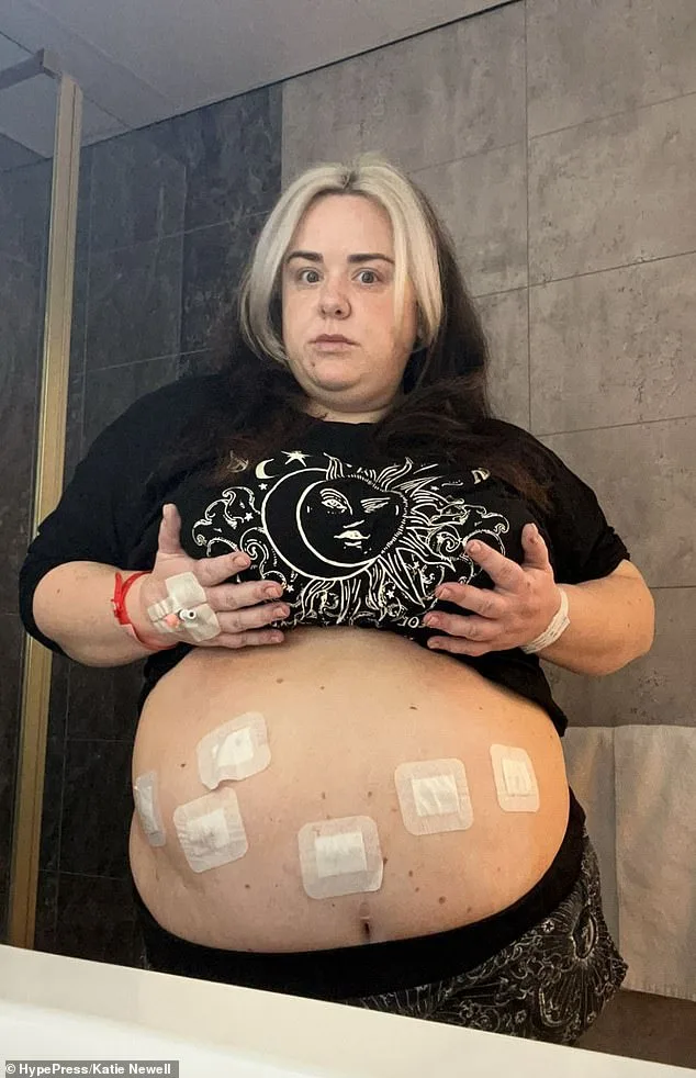 Katie Newell's Battle with Obesity and Chronic Illness: A Journey of Struggle and Resilience