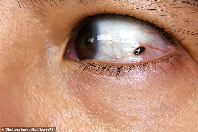 A Subtle Freckle and Sudden Symptoms: The Eye Exam That Changed Everything