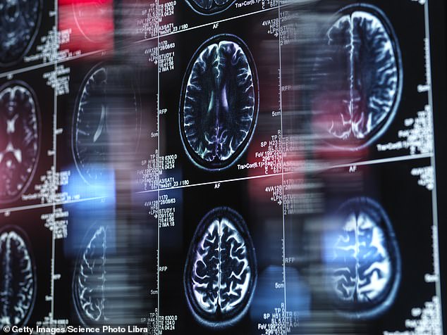 UK Dementia Cases Reach Half a Million with Growing Concern Over Young-Onset