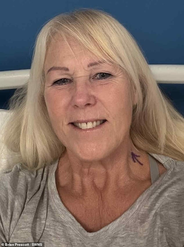 Silent Signs: Margot Blair's Tongue Cancer Journey and Overlooked Symptoms