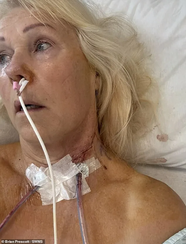 Silent Signs: Margot Blair's Tongue Cancer Journey and Overlooked Symptoms