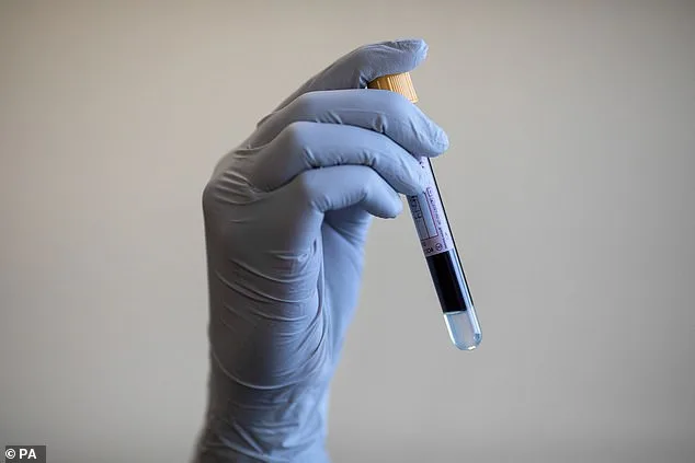 Brain Cancer Survival Rates Lag as Genetic Testing Access Sparks Controversy in UK NHS