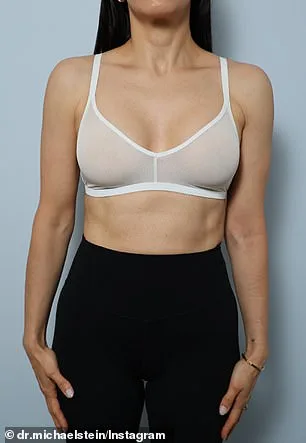 From Big to Balanced: The 'Ballerina Breast' Trend Redefines Modern Beauty Standards