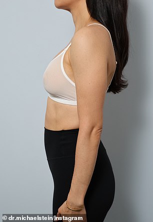 From Big to Balanced: The 'Ballerina Breast' Trend Redefines Modern Beauty Standards