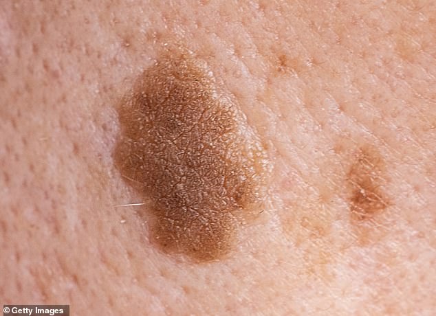 Trump's Mysterious Rash Sparks Health Speculation Despite Doctor's Statement