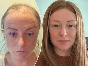 Grey Hair Linked to Natural Cancer Defense Mechanism, Study Reveals