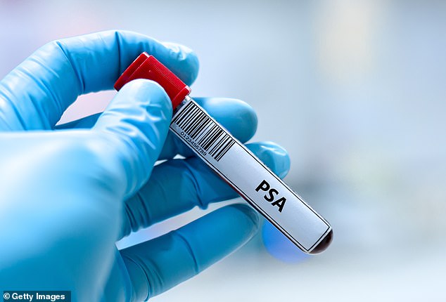 Prostate Cancer Screening May Match Effectiveness of Breast Cancer Programme, Study Indicates