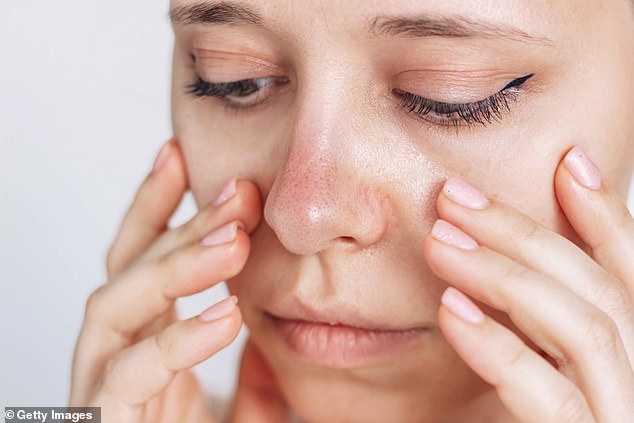 Unraveling an Atypical Raynaud's Mystery: Persistent Nasal Coldness Baffles Doctors