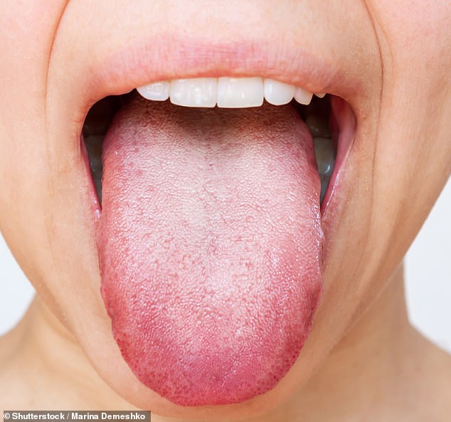 Tingling Tongue: A Hidden Health Warning – When Allergies and More Are to Blame