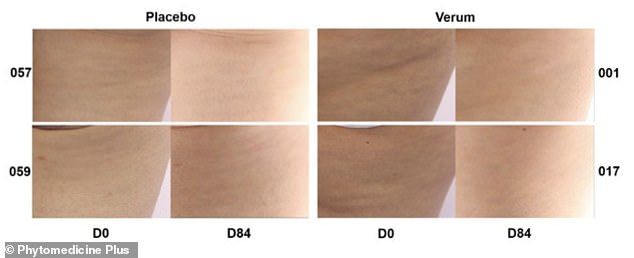 French Maritime Pine Bark Extract May Revolutionize Cellulite Treatment with Promising Clinical Results