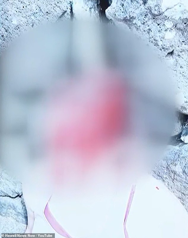 Hawaii Doctor's Self-Defense Claim in Attempted Murder Trial