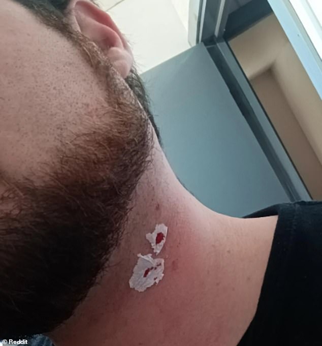 Single-Blade Razors Resurge, But Pose Hidden Risks of Cuts and Irritation