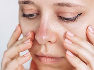 Mounjaro: Effective for Weight Loss but Linked to Nausea and Hair Loss