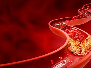 11 Additional Minutes of Sleep May Reduce Heart Attack Risk as Much as Medication, Study Suggests