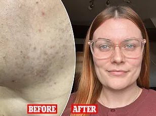 Metformin May Mimic Exercise Benefits, Offering New Hope for Weight Control and Heart Health