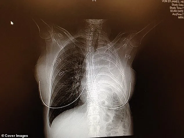 The Faded Bomber Jacket That Foreshadowed a Deadly Disease